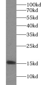 ISG15 antibody|ISG15抗体