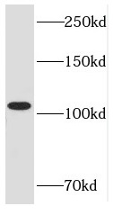 RB1 antibody|RB1抗体 FNab07142