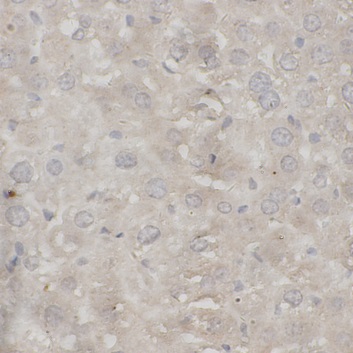 F5 antibody|F5抗体