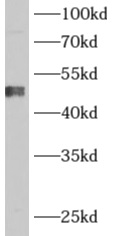 ADHFE1 antibody|ADHFE1抗体 FNab0