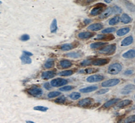 LCE1B antibody|LCE1B抗体