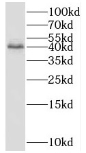 FUCA2 antibody|FUCA2抗体 FNab102