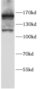 MSH6 antibody|MSH6抗体 FNab10369