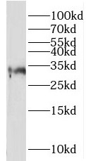 CLTRN antibody|CLTRN抗体 FNab087