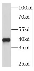 RDH10 antibody|RDH10抗体