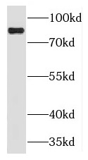 PLCD3 antibody|PLCD3抗体