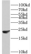 PPP1R14B antibody|PPP1R14B抗体