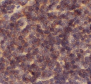 CASP1 antibody|CASP1抗体 FNab012