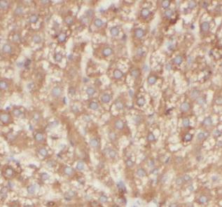 COQ10A antibody|COQ10A抗体