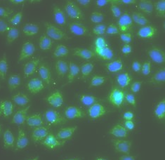 RAC1 antibody|RAC1抗体 FNab07064