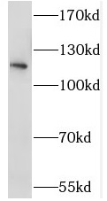 STK31 antibody|STK31抗体