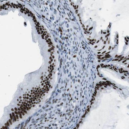 PHF6 antibody|PHF6抗体