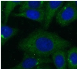 KRT8 antibody|KRT8抗体 FNab02221