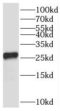 TMEM41A antibody|TMEM41A抗体