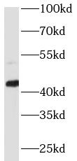 Phospho-CREB1(S133) antibody|P