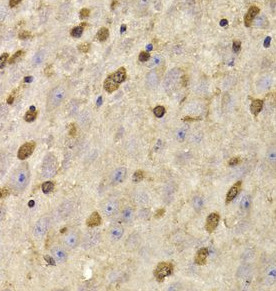 QKI antibody|QKI抗体