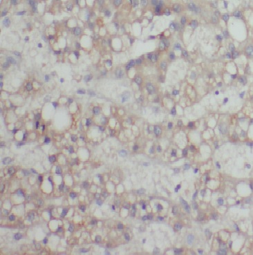 CYP2J2 antibody|CYP2J2抗体