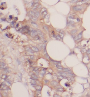 UBA5 antibody|UBA5抗体