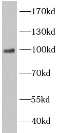 EWSR1 antibody|EWSR1抗体 FNab101