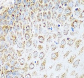 GLUD1 antibody|GLUD1抗体