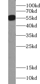 ZMPSTE24 antibody|ZMPSTE24抗体