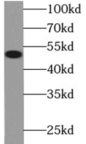 MYC antibody|MYC抗体 FNab01791