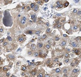 HSF2 antibody|HSF2抗体 FNab10025