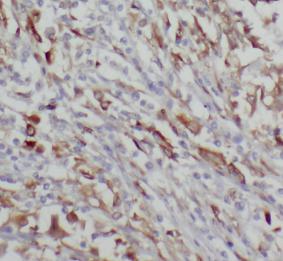 CHGA antibody|CHGA抗体 FNab01686