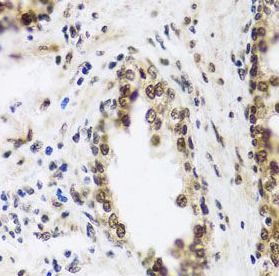 SAFB2 antibody|SAFB2抗体