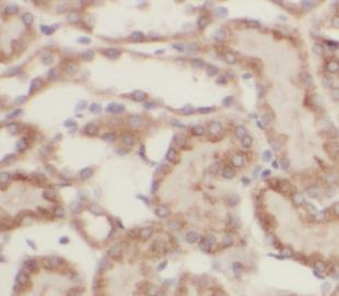 CYP2D6 antibody|CYP2D6抗体 FNab0