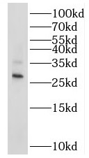 RAB20 antibody|RAB20抗体