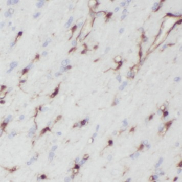 ENO2 antibody|ENO2抗体 FNab05867