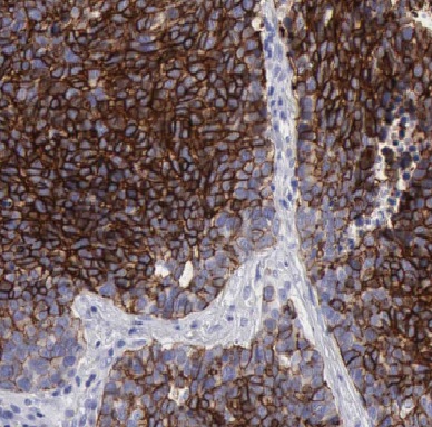 KRT7 antibody|KRT7抗体 FNab02217