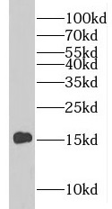 PLP2 antibody|PLP2抗体
