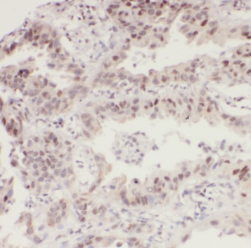 RAB1A antibody|RAB1A抗体