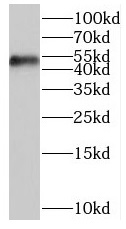 ORC5 antibody|ORC5抗体