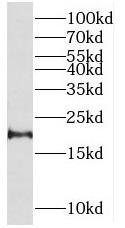 RHEB antibody|RHEB抗体 FNab07280