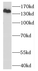 OTUD4 antibody|OTUD4抗体