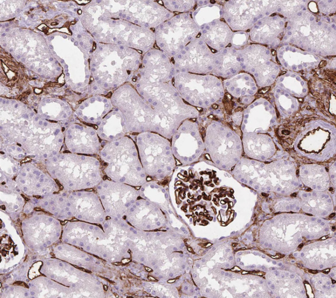 SPATS2L antibody|SPATS2L抗体