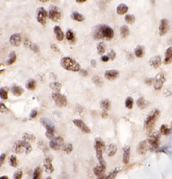 NFE2L1 antibody|NFE2L1抗体 FNab0