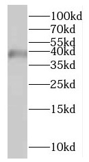 HSDL1 antibody|HSDL1抗体