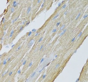 CKMT2 antibody|CKMT2抗体