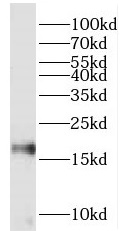 PIN1 antibody|PIN1抗体
