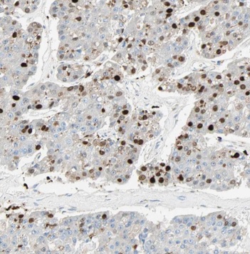 POLI antibody|POLI抗体