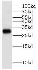 KCNIP4 antibody|KCNIP4抗体
