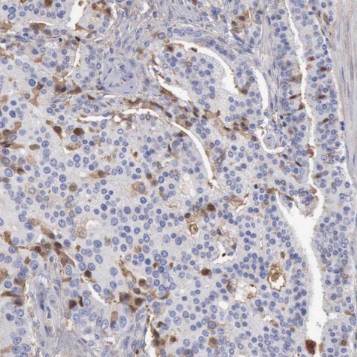 SPON2 antibody|SPON2抗体