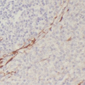 PAFAH1B3 antibody|PAFAH1B3抗体 F