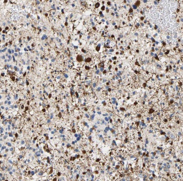 PNMA1 antibody|PNMA1抗体