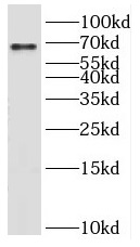 KLHL21 antibody|KLHL21抗体