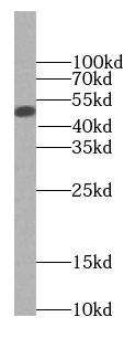 BCS1L antibody|BCS1L抗体 FNab008
